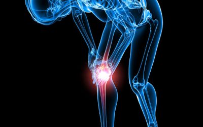 Determining When to Consult a Knee Pain Doctor in Fall River, MA