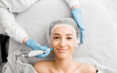 Rejuvenate Your Skin with Chemical Peels in Macon, GA